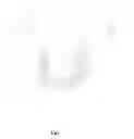 Fig. 02 - Highly Flexible Absorbent Article Having Stiffened Landing Zone