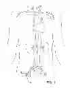 Fig. 02 - Transvascular access device and method