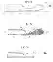 Fig. 07 - CORPOREAL CATHETER
