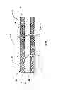 Fig. 08 - Atraumatic ureteral access sheath