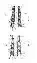 Fig. 09 - Atraumatic ureteral access sheath