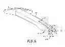 Fig. 07 - Transcutaneous implant tools, systems and methods