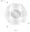 Fig. 02 - Erodible embolization material for targeted tumor cryoablation