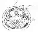 Fig. 01 - Percutaneous methods and devices for carotid body ablation
