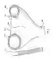 Fig. 04 - Percutaneous methods and devices for carotid body ablation