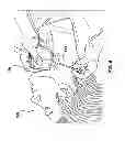 Fig. 06 - Percutaneous methods and devices for carotid body ablation