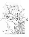 Fig. 07 - Percutaneous methods and devices for carotid body ablation