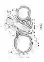 Fig. 28 - Percutaneous methods and devices for carotid body ablation