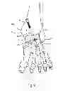 Fig. 08 - Joint arthrodesis and arthroplasty