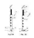 Fig. 09 - Joint arthrodesis and arthroplasty