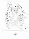 Fig. 04 - Robotic surgical system and method for automated therapy delivery