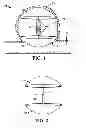 Fig. 02 - Intra-aneurysm devices