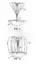 Fig. 03 - Intra-aneurysm devices