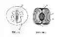 Fig. 04 - Intra-aneurysm devices