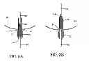 Fig. 06 - Intra-aneurysm devices