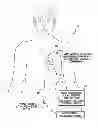 Fig. 01 - Systems and methods for controlling neurostimulation based on regional cardiac performance for use by implantable medical devices