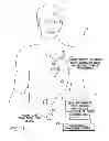 Fig. 02 - Systems and methods for controlling neurostimulation based on regional cardiac performance for use by implantable medical devices