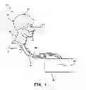 Fig. 02 - METHOD AND APPARATUS FOR COOLING THE HEAD OR NECK OF A PATIENT