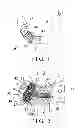 Fig. 02 - TEXTURED IMPLANT DEVICE