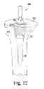 Fig. 28 - Tibial trial instruments and method of using same