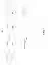 Fig. 09 - Short circuit of probes in a chain