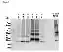 Fig. 20 - Modified Protein Body Tags and Production Methods Thereof