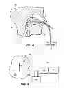 Fig. 06 - Portable, adjustable disposable medical suction system and method of use