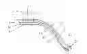 Fig. 01 - Layered soft palate support and implantation method