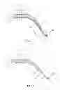 Fig. 02 - Layered soft palate support and implantation method