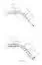 Fig. 03 - Layered soft palate support and implantation method