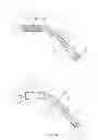 Fig. 04 - Layered soft palate support and implantation method