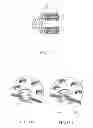Fig. 09 - Layered soft palate support and implantation method