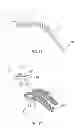 Fig. 12 - Layered soft palate support and implantation method