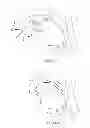 Fig. 13 - Layered soft palate support and implantation method