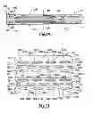 Fig. 09 - Staple cartridge comprising a staple driver arrangement