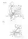 Fig. 04 - Belt-strap arrester