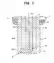 Fig. 06 - High-frequency spark plug with center electrode and terminal electrode in direct contact