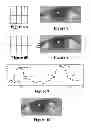 Fig. 06 - Eye beautification under inaccurate localization