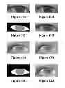 Fig. 07 - Eye beautification under inaccurate localization