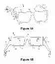 Fig. 02 - External vibration reduction in bone-conduction speaker