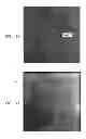 Fig. 07 - Automatic reduction of interfering elements from an image stream of a moving organ