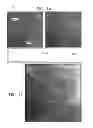 Fig. 09 - Automatic reduction of interfering elements from an image stream of a moving organ