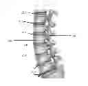 Fig. 01 - Method of obtaining and analyzing data from an upright MRI from the spinal region of a subject