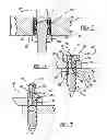 Fig. 07 - Hybrid fastener