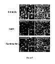 Fig. 06 - Method of treating degenerative disorders of the nervous system