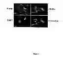 Fig. 10 - Method of treating degenerative disorders of the nervous system
