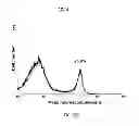 Fig. 38 - Method of treating degenerative disorders of the nervous system