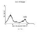 Fig. 47 - Method of treating degenerative disorders of the nervous system