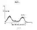 Fig. 48 - Method of treating degenerative disorders of the nervous system