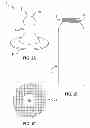 Fig. 02 - METHODS AND DEVICES FOR INFANT FEEDING